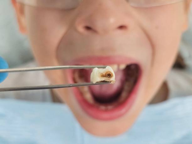 Best Same-Day Emergency Dental Services in Hebron, IL